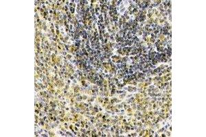 Immunohistochemical analysis of IL-1F10 staining in human spleen formalin fixed paraffin embedded tissue section.