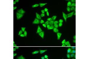 Immunofluorescence analysis of HeLa cells using ADSL Polyclonal Antibody (Adenylosuccinate Lyase anticorps)