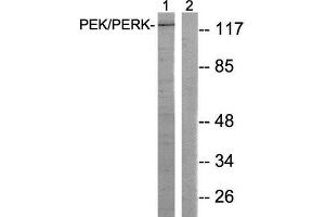 Western Blotting (WB) image for anti-Eukaryotic Translation Initiation Factor 2-alpha Kinase 3 (EIF2AK3) (Thr981) antibody (ABIN1848258) (PERK anticorps  (Thr981))