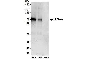 Western Blotting (WB) image for anti-Pleckstrin Homology-Like Domain, Family B, Member 2 (PHLDB2) (AA 250-300) antibody (ABIN7450420)