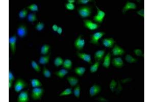Immunofluorescence staining of Hela cells with ABIN7169187 at 1:100, counter-stained with DAPI. (TAO Kinase 1 (TAOK1) (AA 400-659) anticorps)