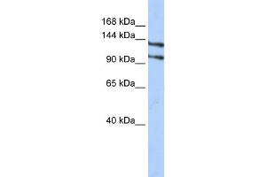WB Suggested Anti-RBM5 Antibody Titration:  0. (RBM5 anticorps  (N-Term))