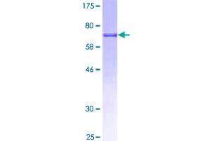 Image no. 1 for Proline Arginine Rich End Leucine Rich Repeat Protein (PRELP) (AA 1-382) protein (GST tag) (ABIN1316175)