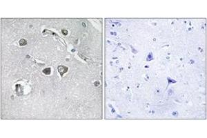 Immunohistochemistry analysis of paraffin-embedded human brain tissue, using Collagen XI alpha2 Antibody. (COL11A2 anticorps  (AA 1211-1260))