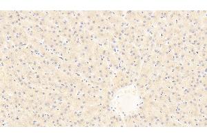 Detection of IL1RL1 in Human Liver Tissue using Polyclonal Antibody to Interleukin 1 Receptor Like Protein 1 (IL1RL1) (IL1RL1 anticorps  (AA 162-349))