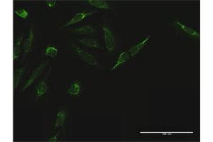 Immunofluorescence of purified MaxPab antibody to TIMM44 on HeLa cell. (TIMM44 anticorps  (AA 1-452))