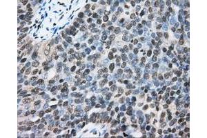 Immunohistochemical staining of paraffin-embedded Kidney tissue using anti-CYP1A2 mouse monoclonal antibody. (CYP1A2 anticorps)