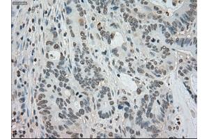 Image no. 1 for anti-Budding Uninhibited By Benzimidazoles 1 Homolog beta (Yeast) (BUB1B) antibody (ABIN1497000) (BUB1B anticorps)