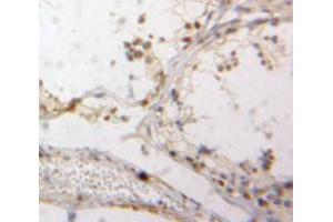 Used in DAB staining on fromalin fixed paraffin-embedded Testis tissue (DR1 anticorps  (AA 2-170))