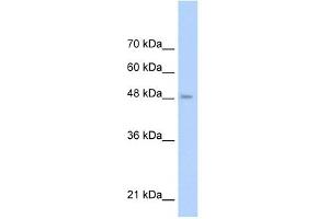 TLR6 antibody used at 1 ug/ml to detect target protein. (TLR6 anticorps  (Middle Region))