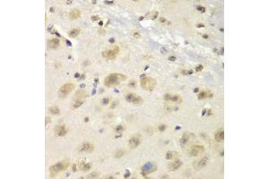 Immunohistochemistry of paraffin-embedded mouse brain using S100A10 antibody (ABIN5971035) at dilution of 1/100 (40x lens). (S100A10 anticorps)