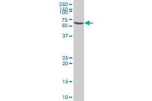 SMARCE1 polyclonal antibody (A01), Lot # 060529JCS1.