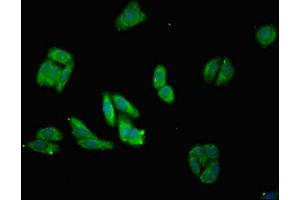 anti-Mitochondrial Ribosomal Protein L28 (MRPL28) (AA 1-256) antibody