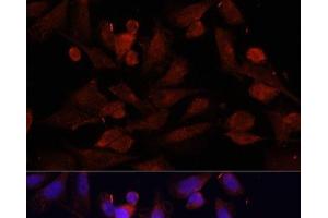 Immunofluorescence analysis of U2OS cells using GPER1 Polyclonal Antibody at dilution of 1:100. (Mesothelin anticorps)