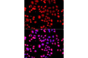 Immunofluorescence analysis of A549 cells using ASPSCR1 antibody (ABIN5975297). (ASPSCR1 anticorps)