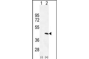 Western blot analysis of PRKAG1 (arrow) using rabbit polyclonal PRKAG1 Antibody (N-term) (ABIN655798 and ABIN2845227).
