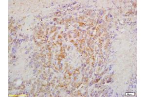 Formalin-fixed and paraffin embedded mouse lymphoma labeled with Rabbit Anti CRTAM Polyclonal Antibody, Unconjugated (ABIN1387894) at 1:200 followed by conjugation to the secondary antibody and DAB staining (CRTAM anticorps  (AA 31-130))