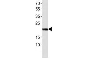 Western blot analysis of lysate from EPO recombinant protein using Erythropoietin antibody at 1:1000.