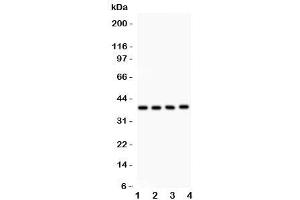 Western blot testing of IkB beta antibody and Lane 1:  mouse kidney (NFKBIB anticorps  (AA 56-237))