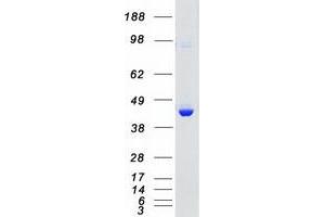 Validation with Western Blot