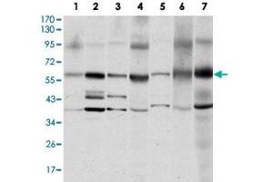 Western blot analysis of SRC monoclonal antobody, clone 1F11  against MCF-7 (1), A-431 (2), HeLa (3), HEK293 (4), NIH/3T3 (5), PC-12 (6) and COS-7 (7) cell lysate. (Src anticorps)