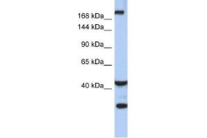 WB Suggested Anti-DISP1 Antibody Titration:  0. (DISP1 anticorps  (Middle Region))