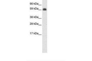 Image no. 1 for anti-Zinc Finger and BTB Domain Containing 45 (ZBTB45) (AA 253-302) antibody (ABIN6735949) (ZBTB45 anticorps  (AA 253-302))