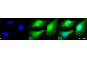 Immunocytochemistry/Immunofluorescence analysis using Rabbit Anti-AKT2 Polyclonal Antibody . (AKT2 anticorps  (C-Term) (Biotin))