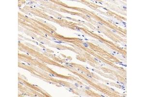 Immunohistochemistry analysis of paraffin-embedded mouse tongue using,TMP1 (ABIN7076030) at dilution of 1: 1600 (Tropomyosin anticorps)
