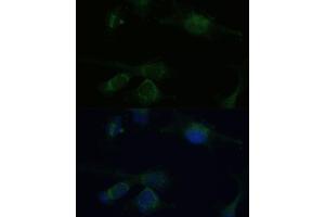 Immunofluorescence analysis of U-251 MG cells using VHL Polyclonal Antibody (ABIN3020967, ABIN3020968, ABIN3020969 and ABIN6213828) at dilution of 1:100 (40x lens).