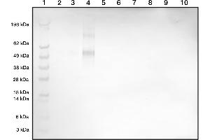 Western blot demonstrating our polyclonal detecting Histamine-BSA conjugate at 1in2000 dilution (1 = Marker, 2 = Histamine-BSA (1 ng), 3 = Histamine-BSA (5 ng), 4 = Histamine-BSA (10 ng), 5 =Blank, 6 = BSA (1 ng), 7 = BSA (5 ng), 8 = BSA (10 ng), 9 =Blank, 10 = Blank)