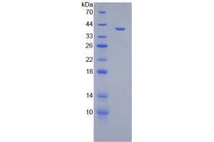 Image no. 1 for Chemokine (C-X-C Motif) Ligand 2 (CXCL2) (AA 32-100) (Active) protein (His tag,GST tag) (ABIN6239880)