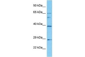 Host:  Rabbit  Target Name:  EGR2  Sample Tissue:  Human HepG2 Whole Cell  Antibody Dilution:  1ug/ml