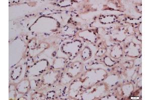 Formalin-fixed and paraffin embedded human kidney labeled with Anti-LMAN1 Polyclonal Antibody Polyclonal Antibody, Unconjugated  at 1:300 followed by conjugation to the secondary antibody and DAB staining.