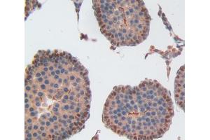 IHC-P analysis of Kidney tissue, with DAB staining. (USP1 anticorps  (AA 1-198))