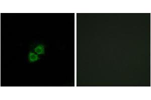 Immunofluorescence analysis of A549 cells, using AIBP antibody. (C1orf135 anticorps)