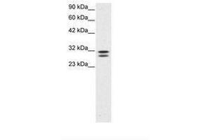Image no. 3 for anti-HIV-1 Tat Interactive Protein 2, 30kDa (HTATIP2) (AA 30-79) antibody (ABIN202114) (HIV-1 Tat Interactive Protein 2, 30kDa (HTATIP2) (AA 30-79) anticorps)