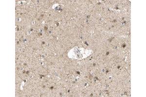 ABIN6267228 at 1/200 staining human brain tissue sections by IHC-P.