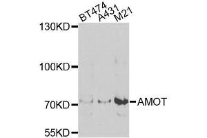 Western blot analysis of extracts of various cell lines, using AMOT antibody. (Angiomotin anticorps  (AA 1-300))