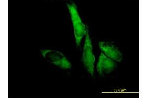 Immunofluorescence of purified MaxPab antibody to EIF3S5 on HeLa cell. (EIF3F anticorps  (AA 1-357))