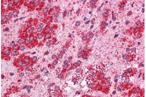 Human Adrenal: Formalin-Fixed, Paraffin-Embedded (FFPE)