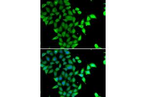 Immunofluorescence analysis of U2OS cells using STAM2 antibody. (STAM2 anticorps)
