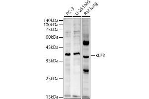 Western blot analysis of extracts of various cell lines, using KLF2 antibody (ABIN7268155) at 1:2720 dilution. (KLF2 anticorps  (AA 50-150))