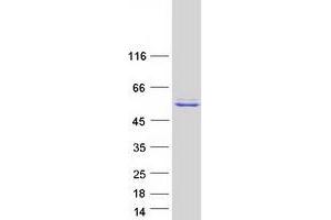 Validation with Western Blot