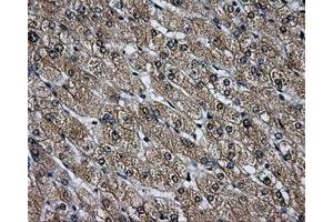 Immunohistochemical staining of paraffin-embedded Ovary tissue using anti-LOXmouse monoclonal antibody. (LOX anticorps  (AA 22-168))