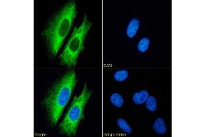 Immunofluorescence staining of fixed HeLa cells with anti-Cytokeratin 7 antibody OV-TL 12/30. (Recombinant Cytokeratin 7 anticorps)