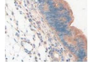 IHC-P analysis of Mouse Uterus Tissue, with DAB staining. (LAMP2 anticorps  (AA 295-410))