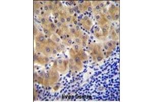 GGH Antibody (C-term) (ABIN655984 and ABIN2845368) immunohistochemistry analysis in formalin fixed and paraffin embedded human liver tissue followed by peroxidase conjugation of the secondary antibody and DAB staining.