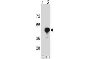 Western blot analysis of CD1c antibody and 293 cell lysate (2 ug/lane) either nontransfected (Lane 1) or transiently transfected (2) with the CD1C gene.