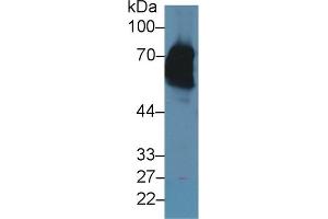 Detection of CK2 in Rat Skin lysate using Polyclonal Antibody to Keratin 2 (CK2)